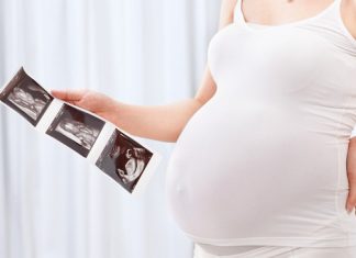 Mối liên quan giữa chiều dài xương mũi thai nhi và hội chứng Down