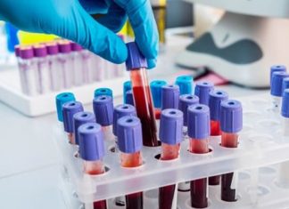 Tìm hiểu về bạch cầu tăng cao ở phụ nữ mang thai