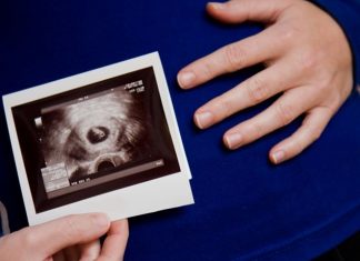 Thai có yolksac là gì? Có gây nguy hiểm đến thai nhi hay không?