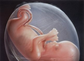 Nước ối nhiều có ảnh hưởng đến thai nhi hay không?